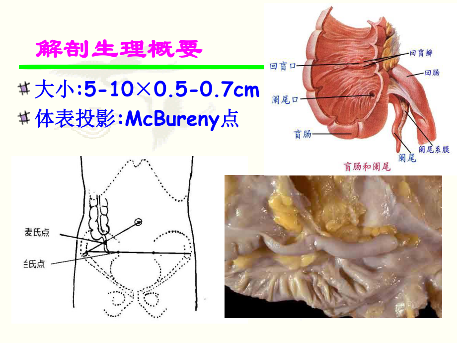 模块二-136阑尾炎.ppt_第3页