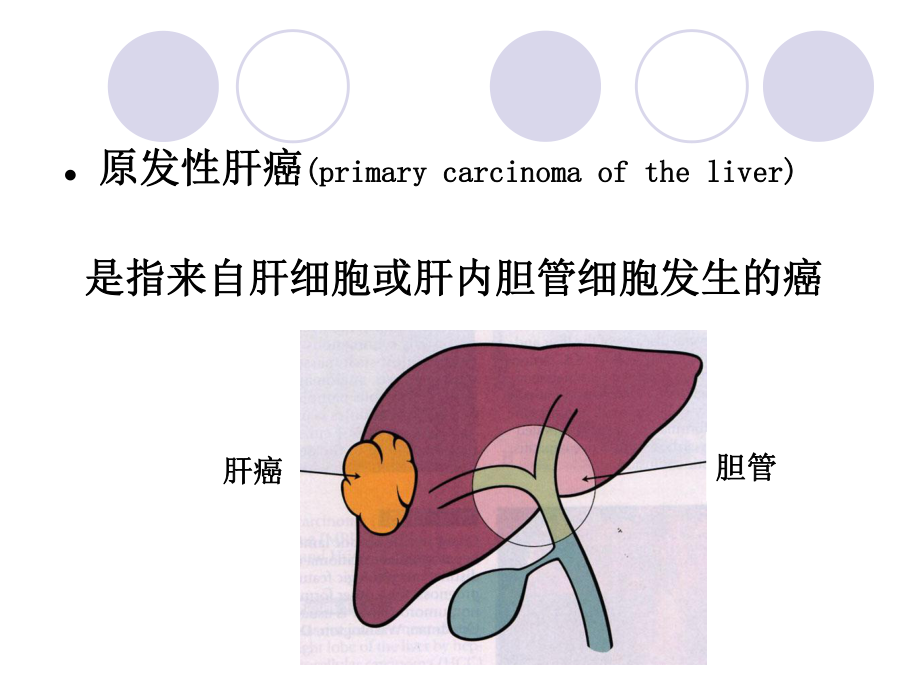 原发性肝癌-俞.ppt_第3页