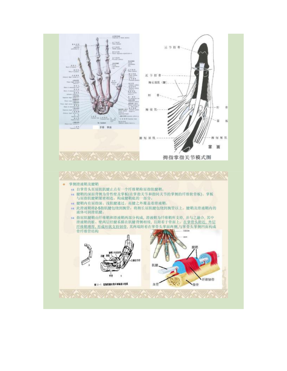 屈指肌狭窄性腱鞘炎解读.doc_第2页