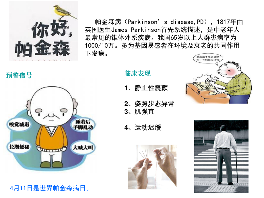 帕金森病科普PPT.ppt_第1页