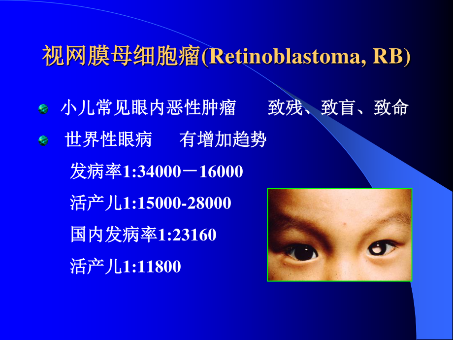 视网膜母细胞瘤的现代诊治.ppt_第3页