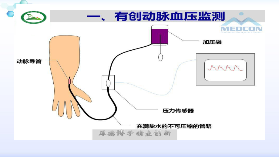 有创血流动力学监测.ppt.pptx_第2页