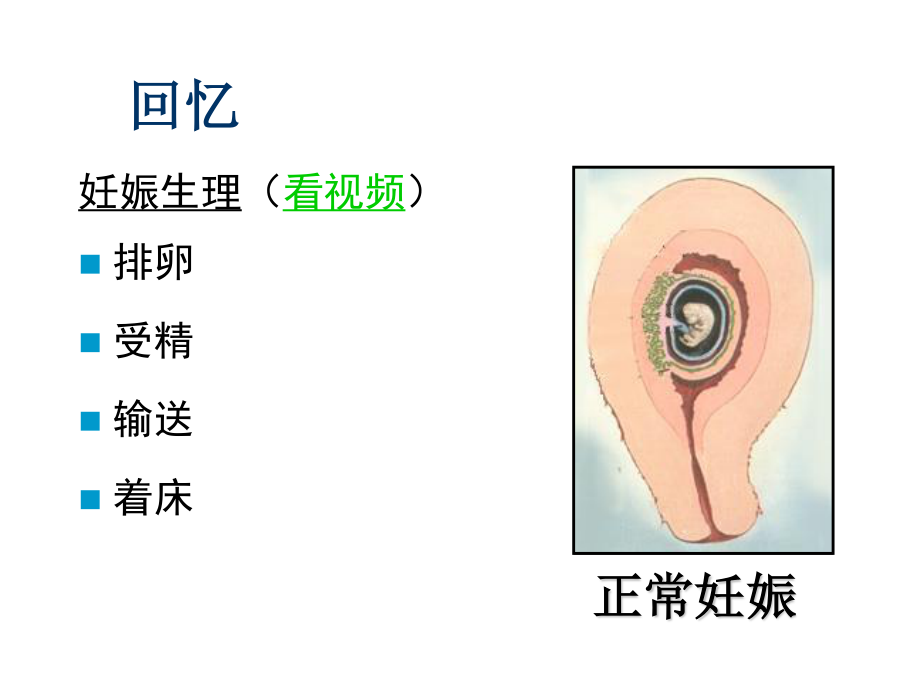 妊娠病异位妊娠.ppt_第3页