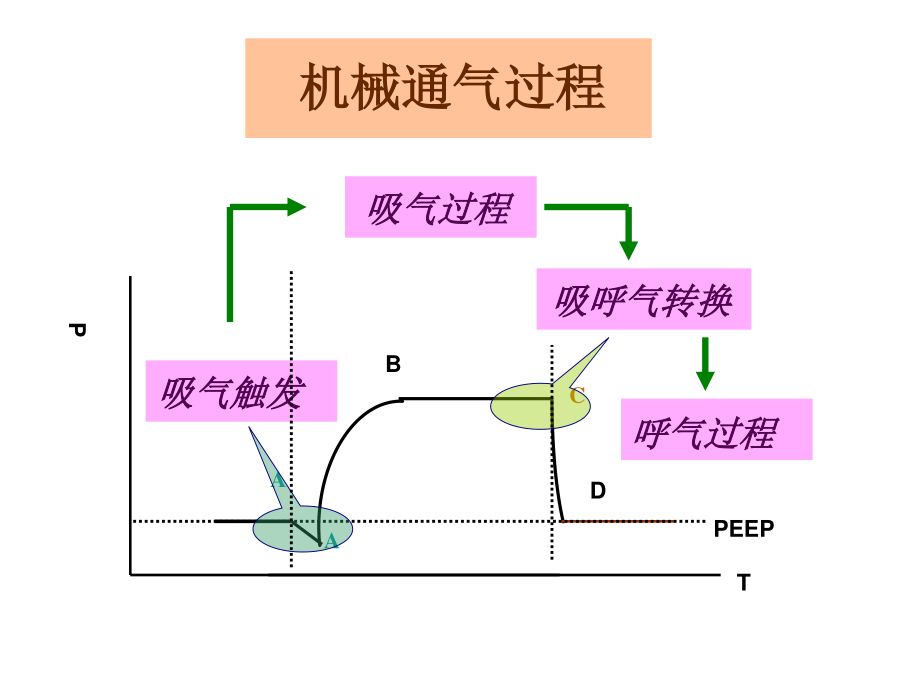 呼吸机的应用.ppt_第2页