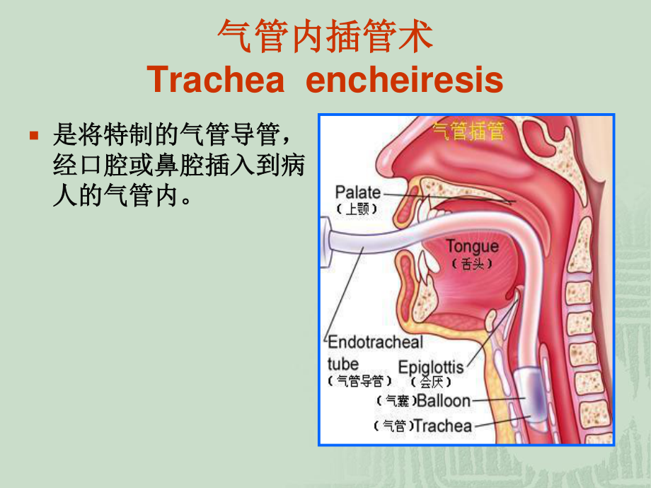 气管插管术.ppt_第3页