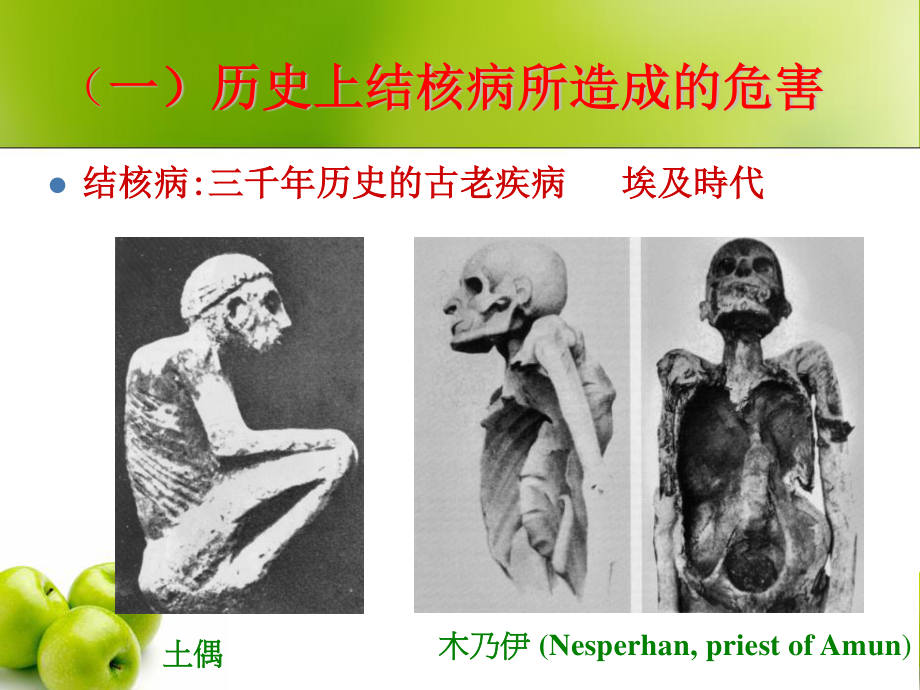 构建无结核病的和谐校园.ppt_第2页