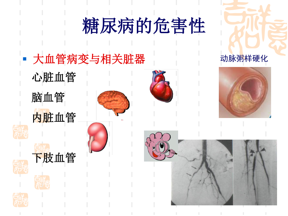 糖尿病综合-围手术.ppt_第2页