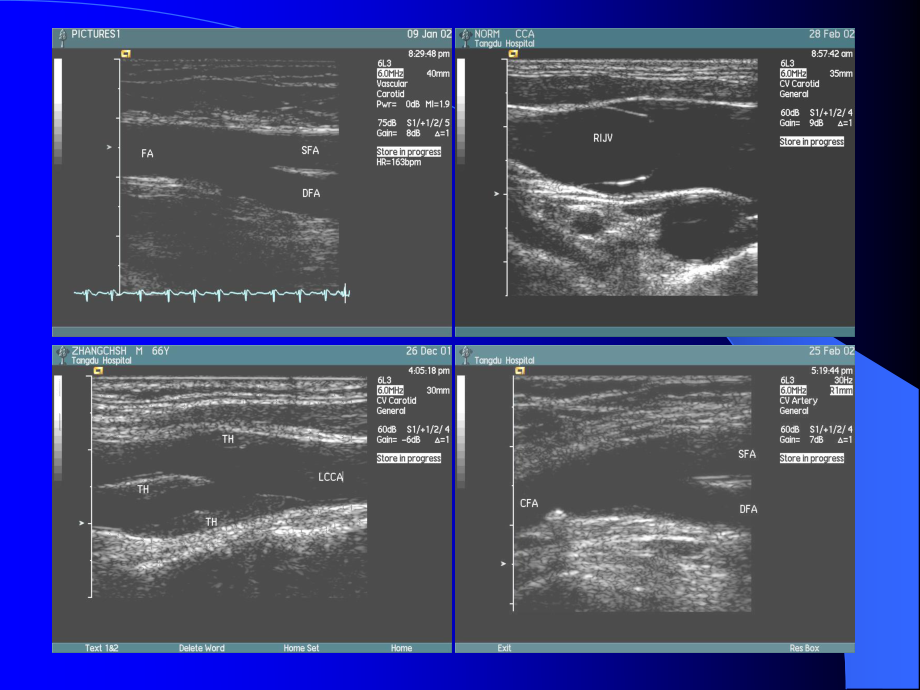 血管超声检查技术.ppt_第3页