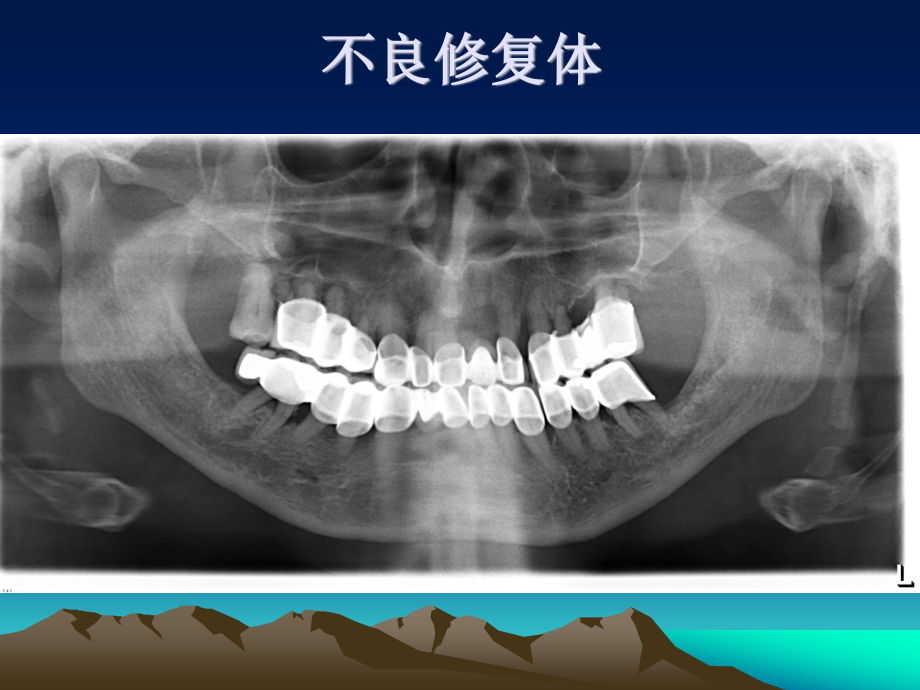 口腔科门诊常见影像.ppt_第2页