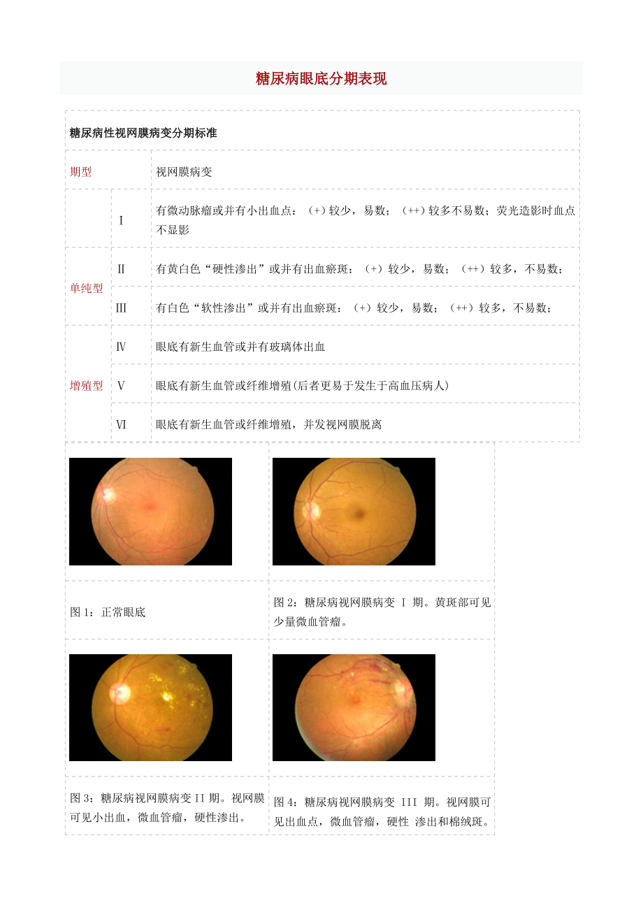 糖尿病眼底分期表现.doc_第1页