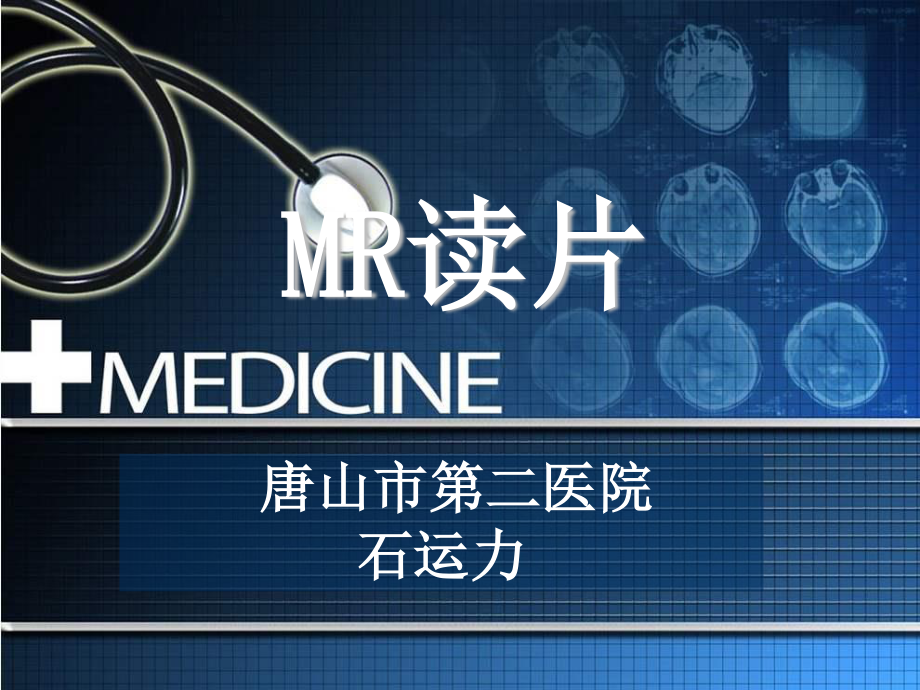 桥小脑角区占位.ppt_第1页