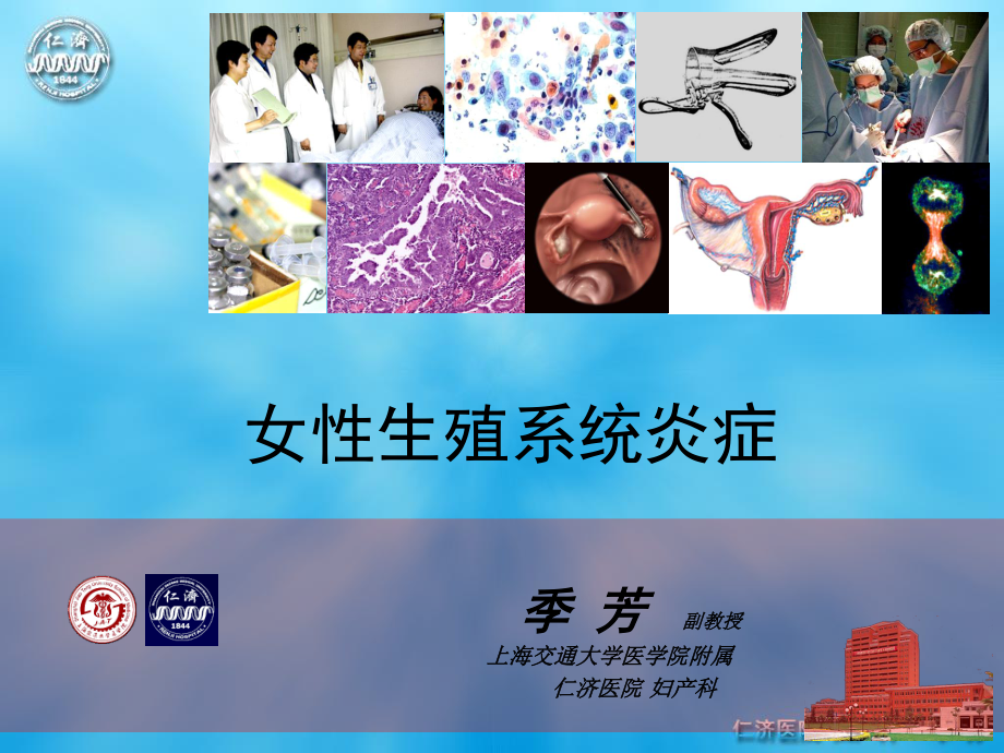 女性生殖系统炎症.ppt_第1页