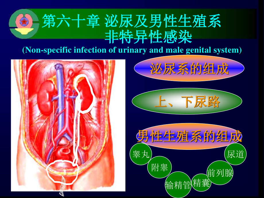 泌尿及男性生殖系感染详解.ppt_第3页