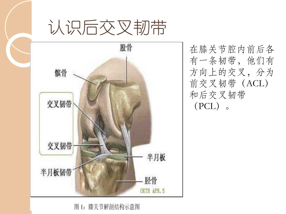 后叉韧带损伤的教学查房.ppt_第3页