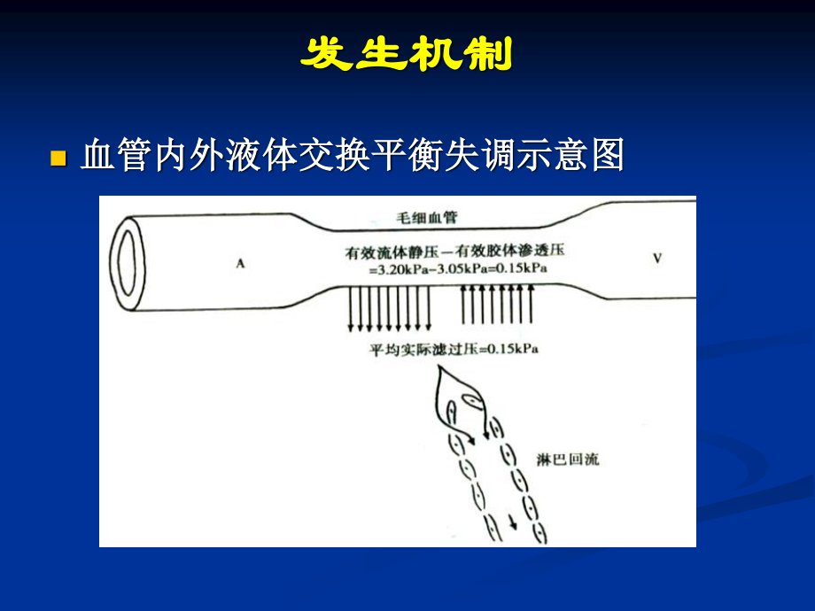 水肿的一般概念.ppt_第3页