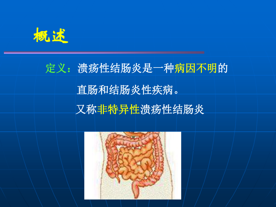 溃疡性结肠炎.ppt_第3页