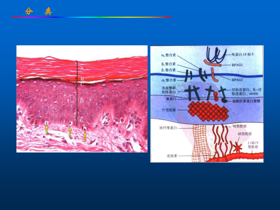 大疱性皮肤病.ppt_第3页