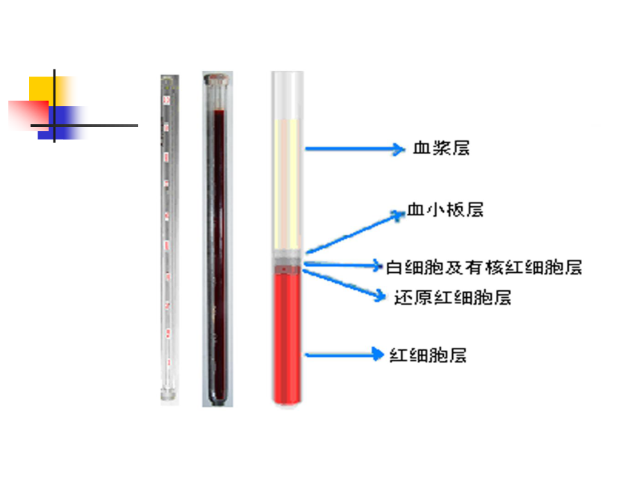 血液一般检验.ppt_第2页