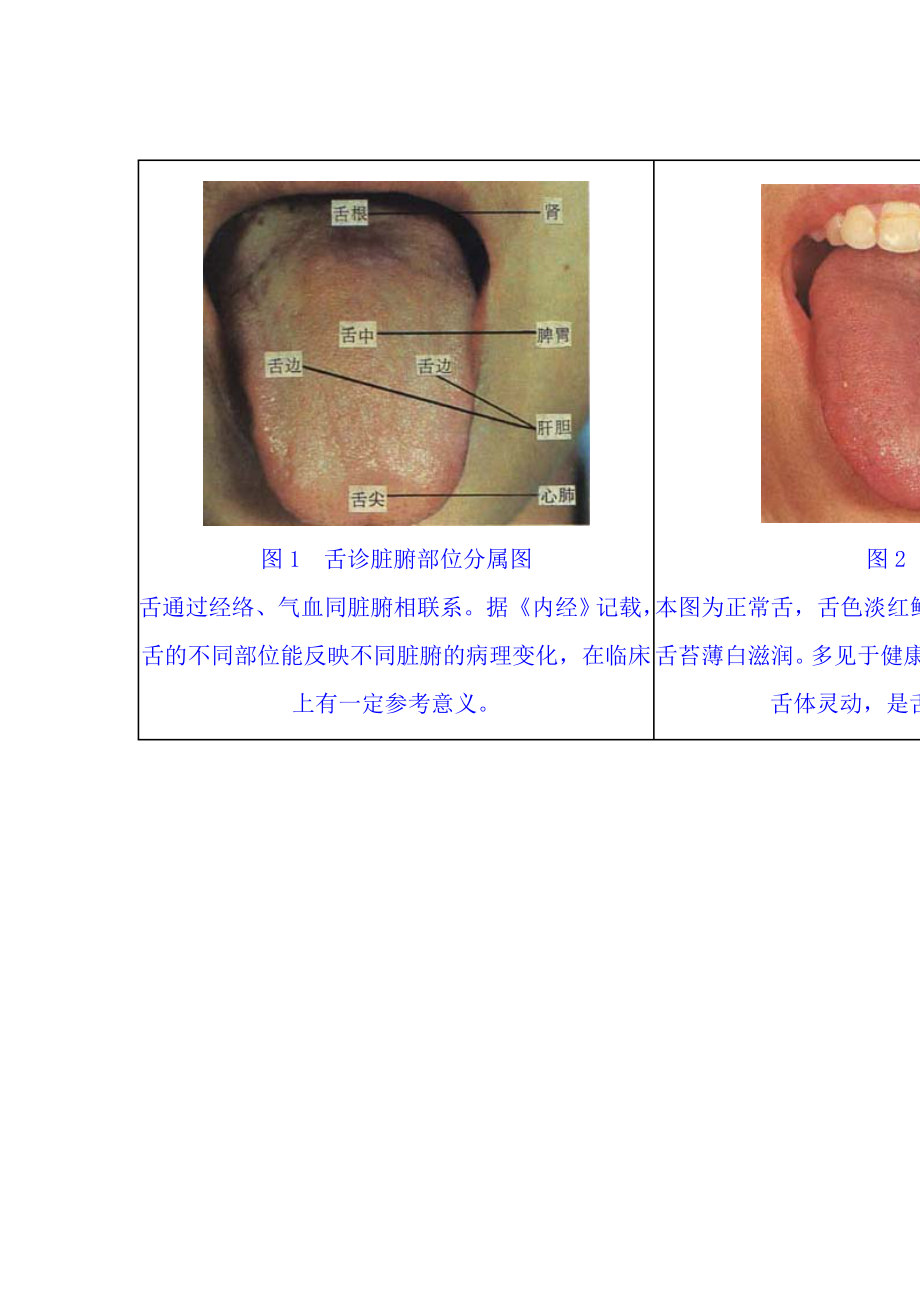 舌苔望诊图谱集.doc_第1页