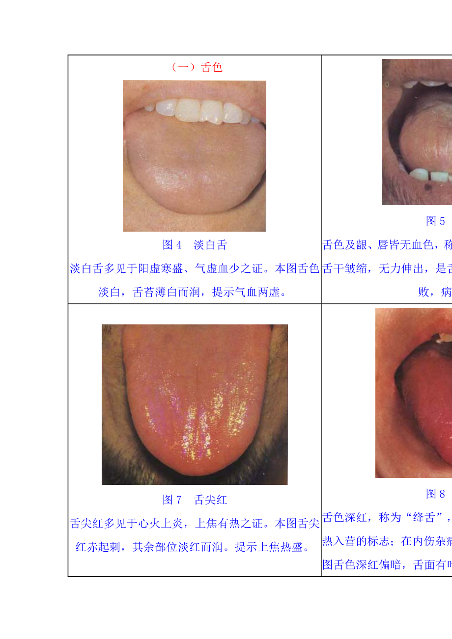 舌苔望诊图谱集.doc_第2页