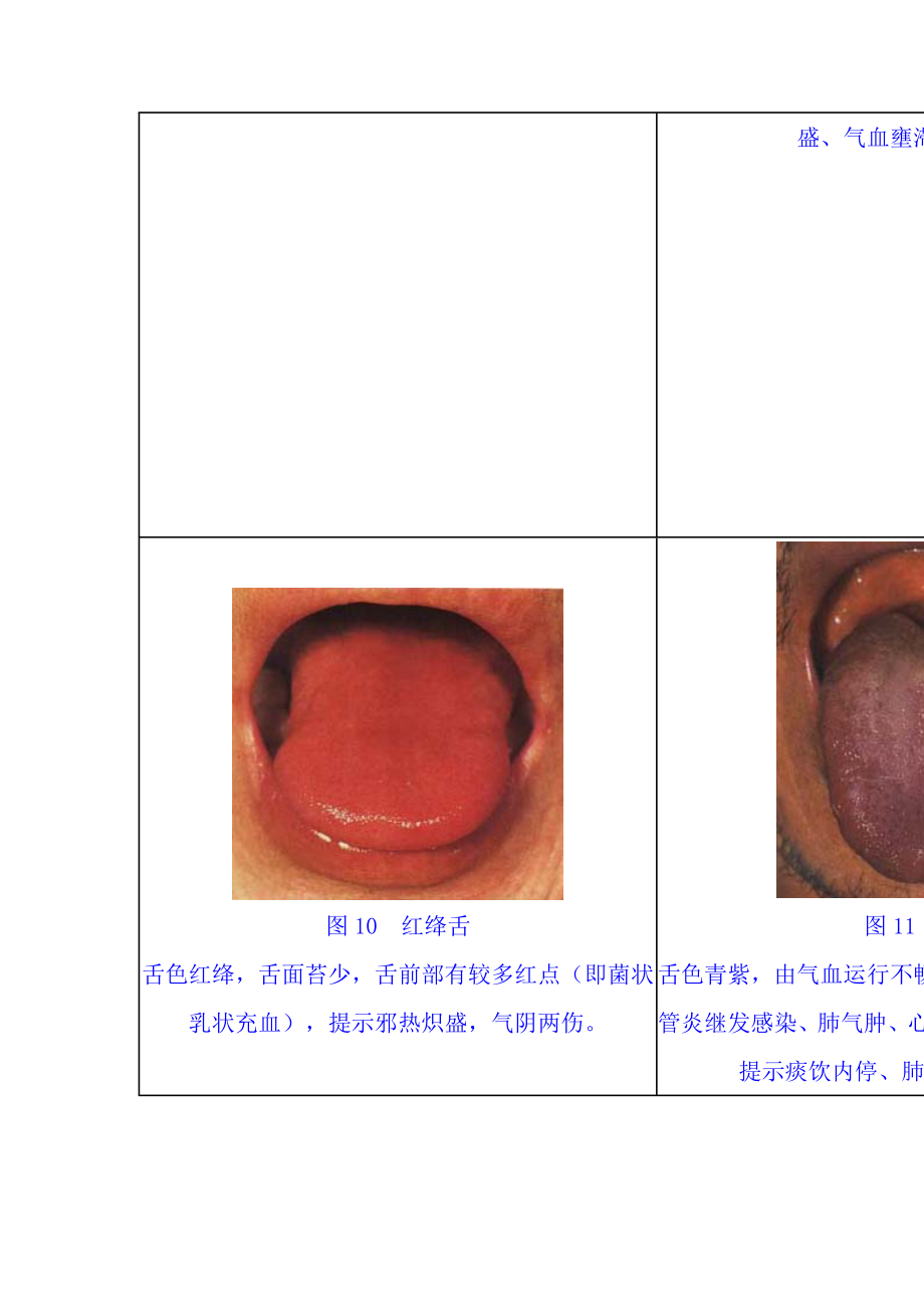 舌苔望诊图谱集.doc_第3页