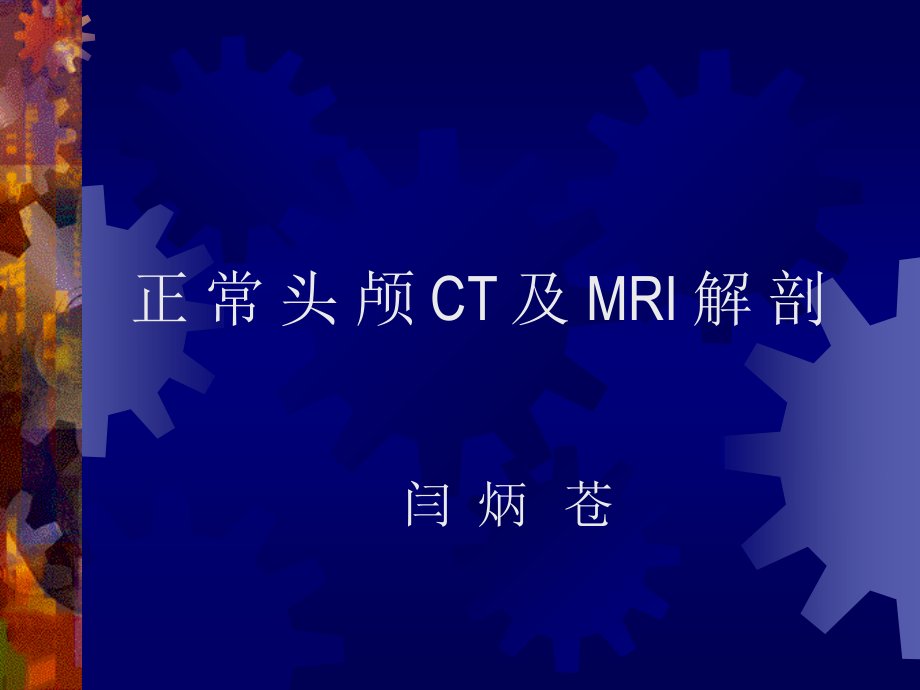 正-常-头-颅-CT-及-MRI-解-剖.ppt_第1页