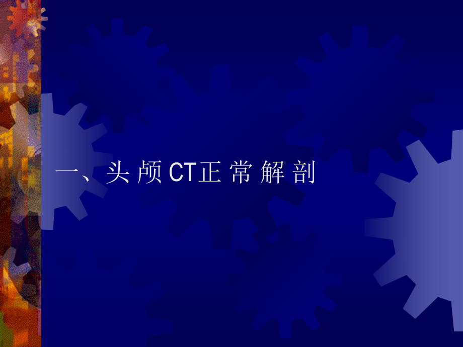 正-常-头-颅-CT-及-MRI-解-剖.ppt_第2页