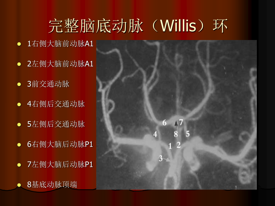 大脑前动脉动脉瘤-用.ppt_第3页