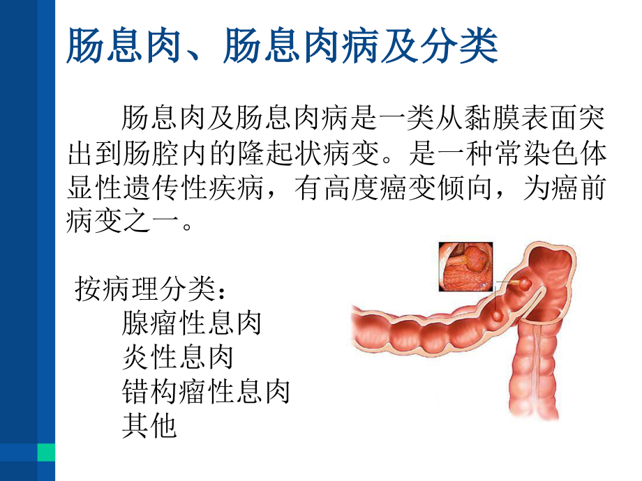 家族性结肠息肉病.ppt_第2页