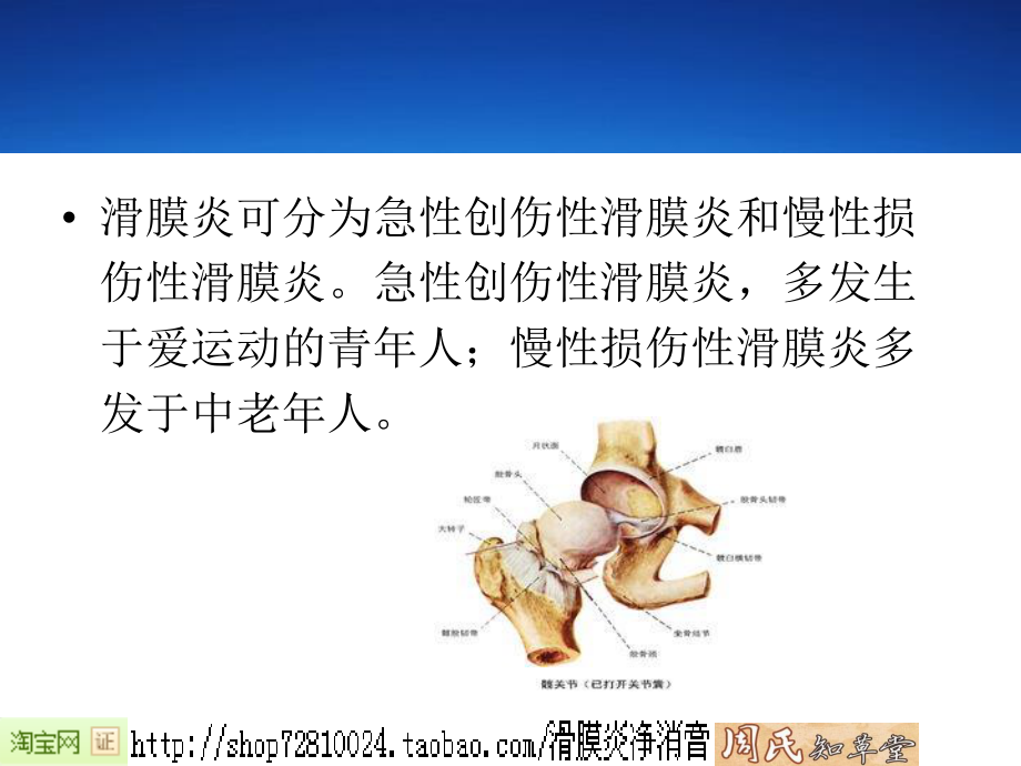 滑膜炎症状汇编.ppt_第3页