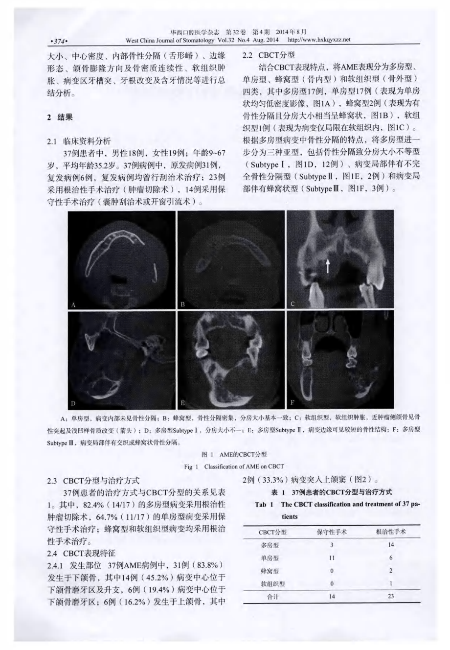 成釉细胞瘤的锥形束CT表现分析.pdf_第2页