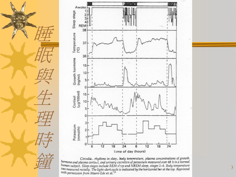 常见睡眠障碍.ppt_第3页