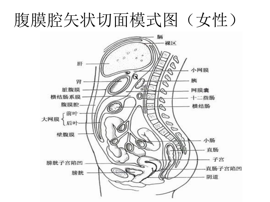 急性腹膜炎.ppt_第3页