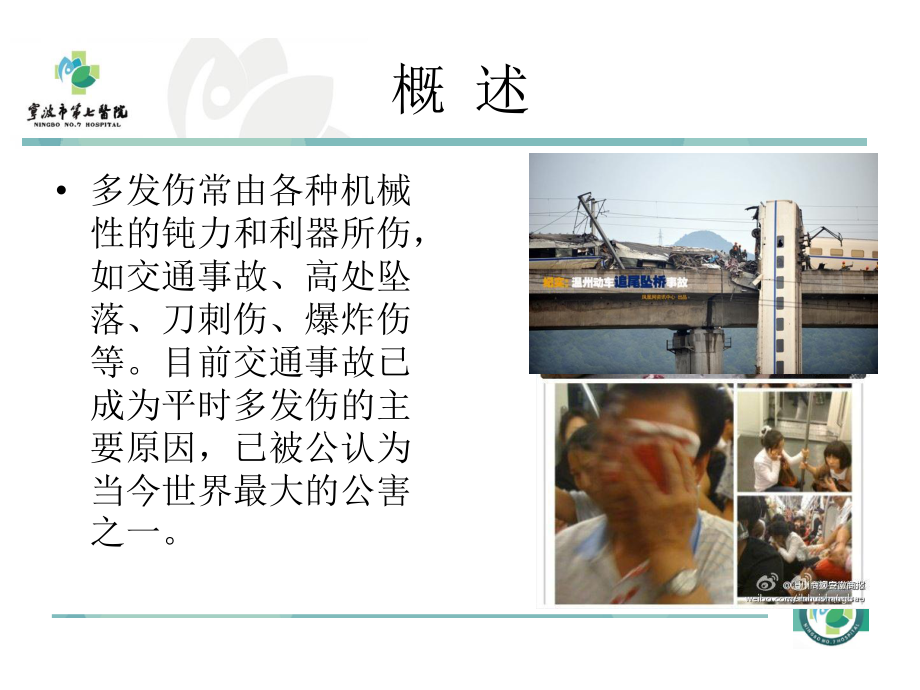 多发伤的急救.ppt_第3页