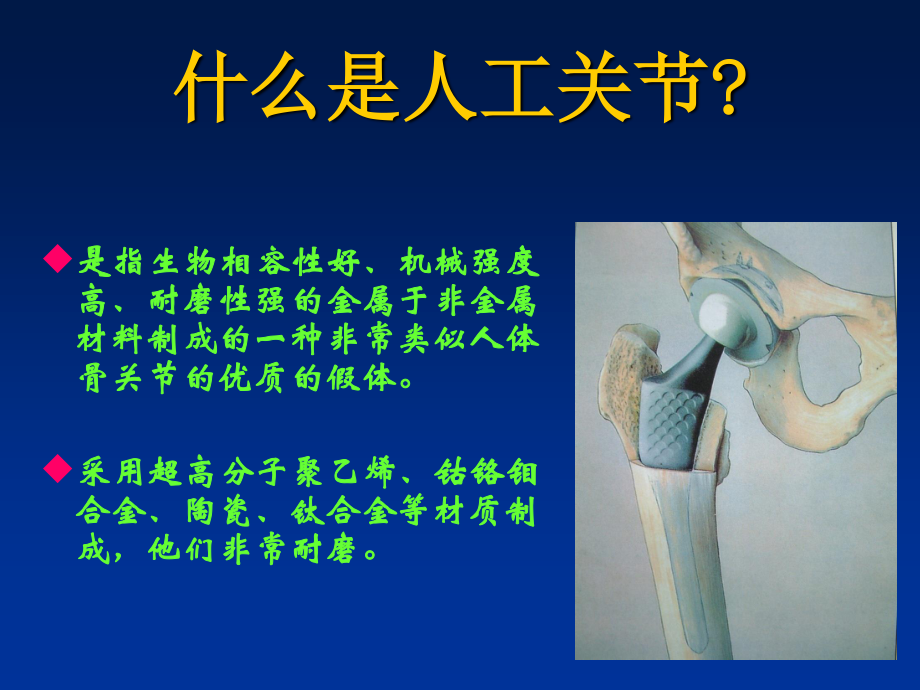 如何延长人工关节的寿命.ppt_第3页