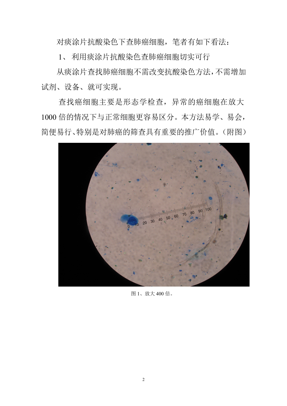 抗酸染色查肺癌做法和体会.doc_第2页