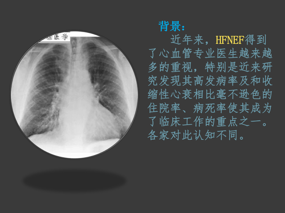 左室射血分数正常的心力衰竭.ppt_第2页