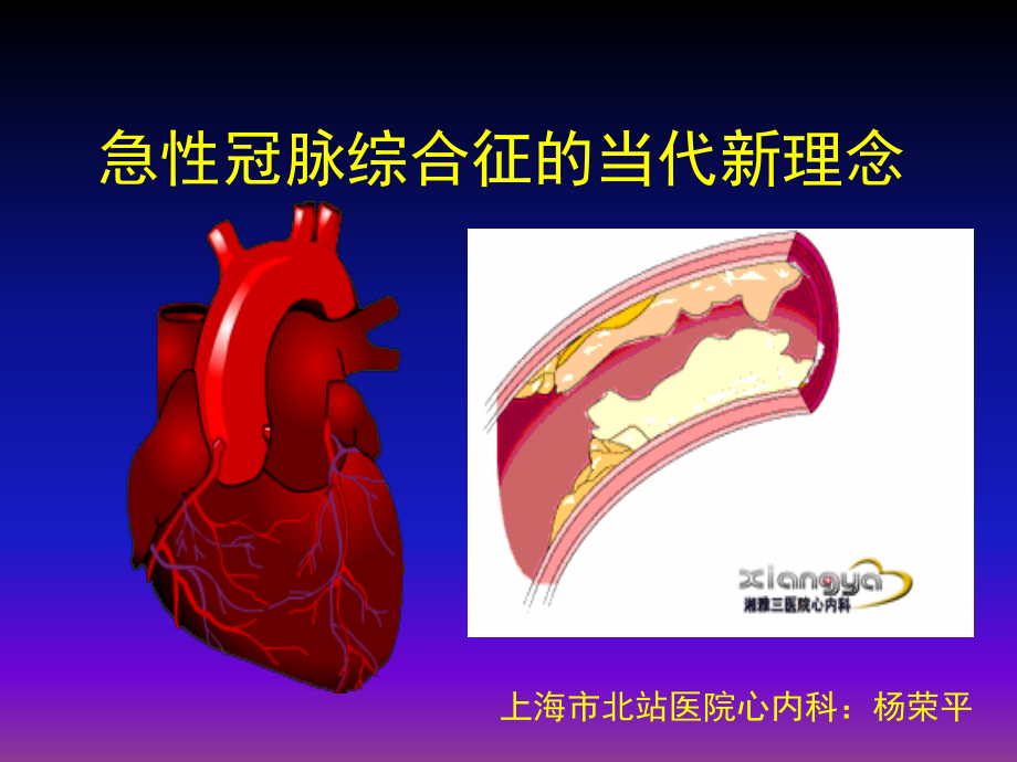 急性冠脉综合征当代新理念(讲稿)1.ppt_第1页