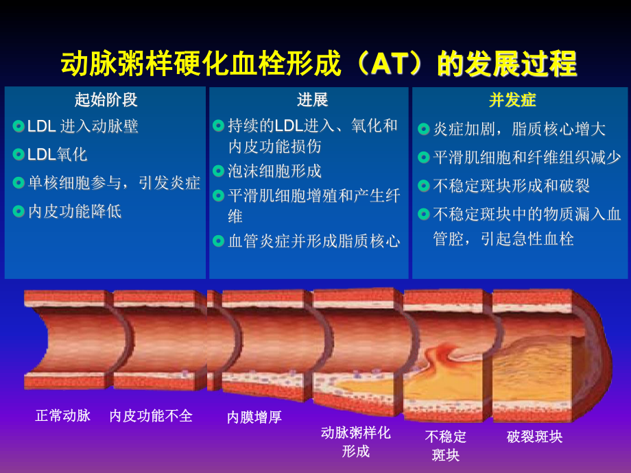 急性冠脉综合征当代新理念(讲稿)1.ppt_第3页