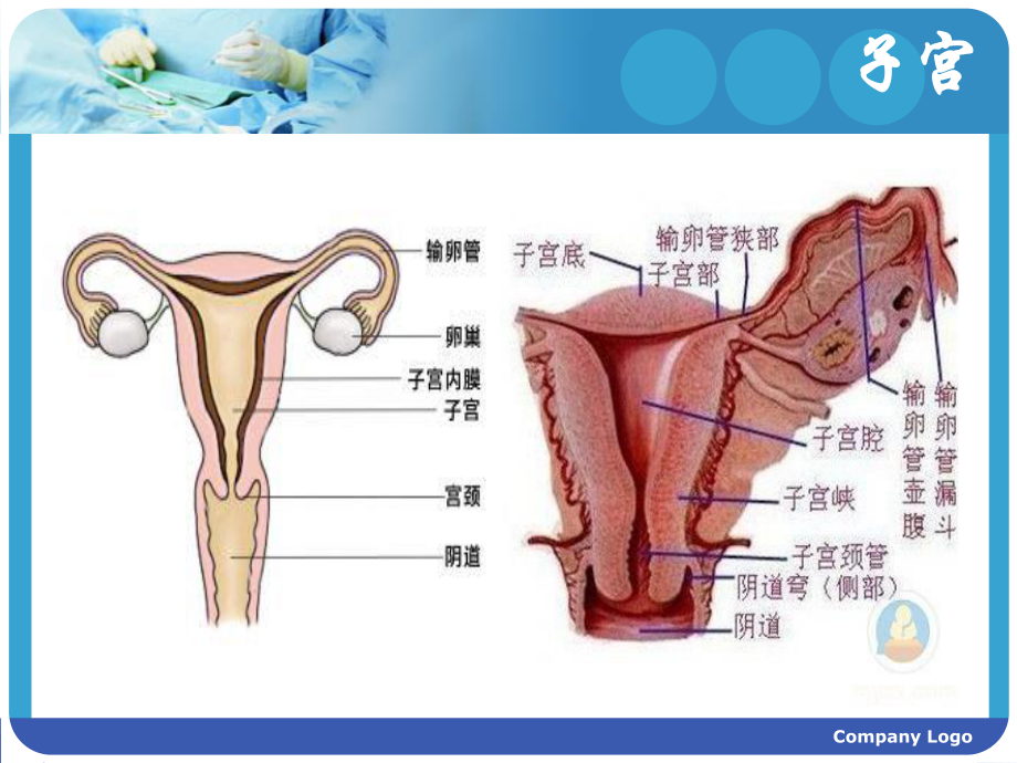 子宫内膜癌的手术配合.pptx_第3页