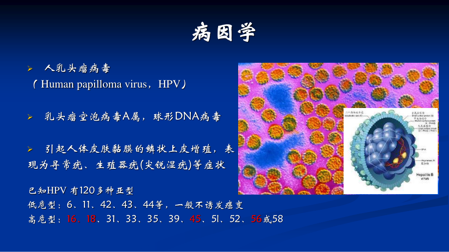 浅谈宫颈癌--贾朝阳.ppt_第3页