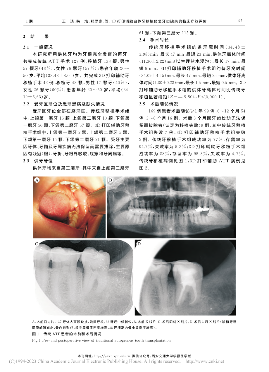 3D打印辅助自体牙移植修复牙齿缺失的临床疗效评价_王琰.pdf_第3页