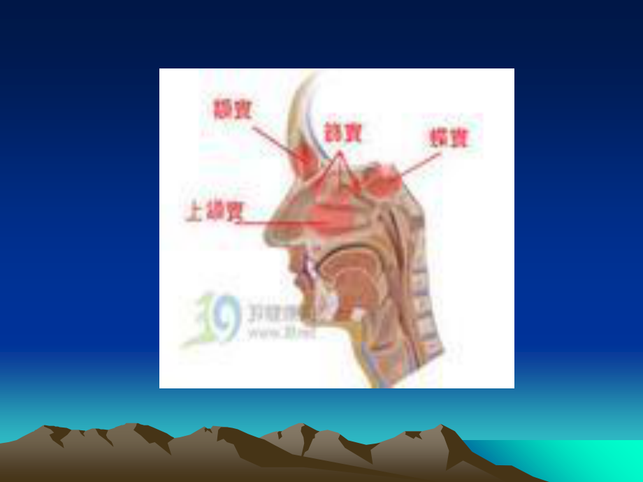 2023年鼻窦炎（教学课件）.ppt_第2页