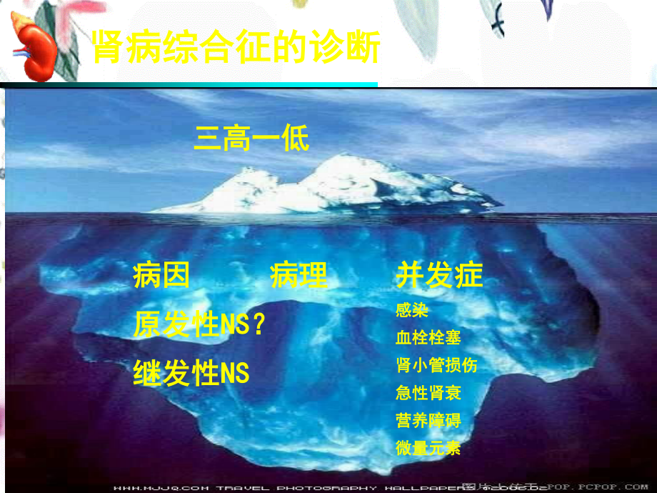 2023年肾病综合征临床常见并发症（教学课件）.ppt_第2页