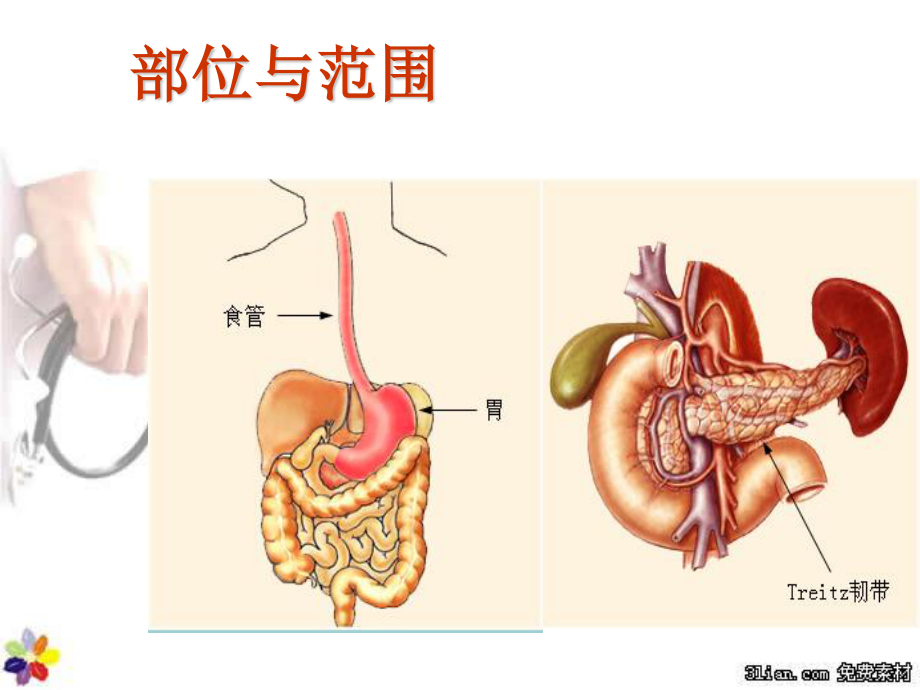 2023年上消化道出血的护理（教学课件）.ppt_第3页