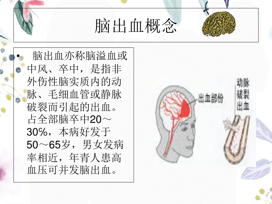 2023年月份护理查房脑出血（教学课件）.ppt_第2页