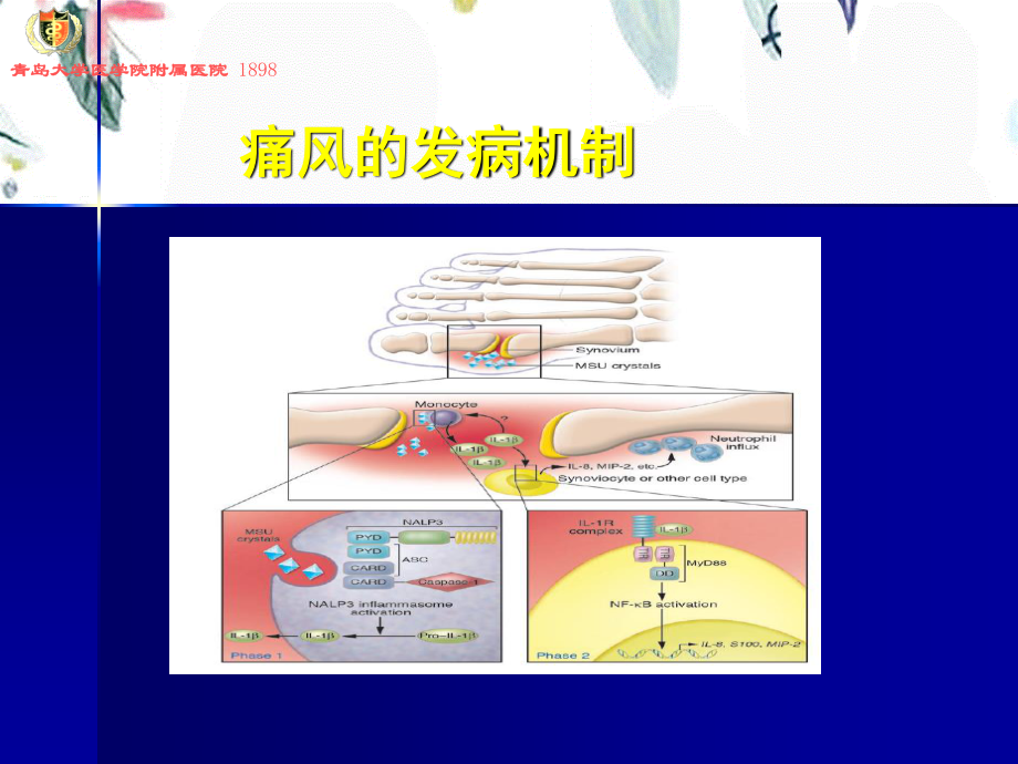 2023年痛风讲座（教学课件）.ppt_第3页