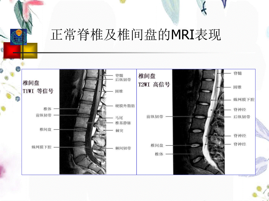 2023年骨骼系统MRI袁飞（教学课件）.ppt_第2页