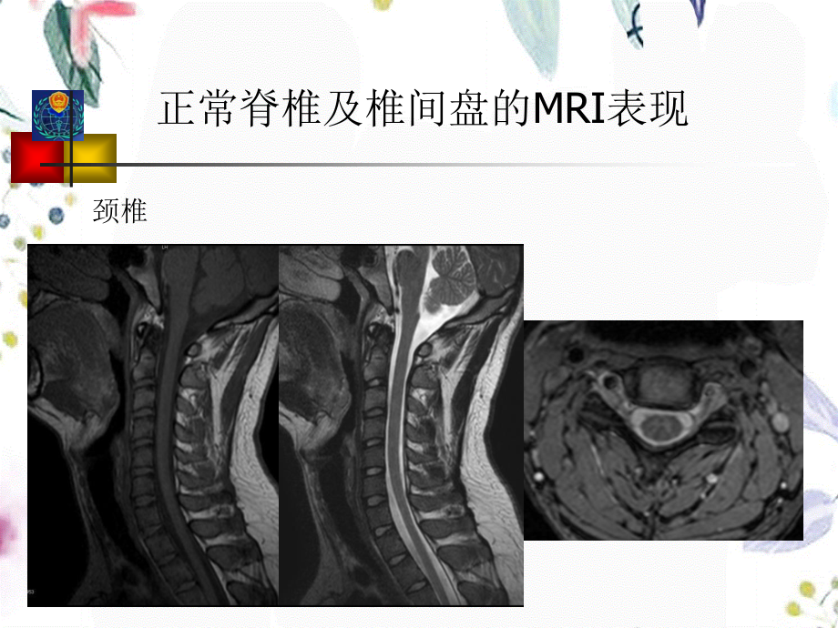 2023年骨骼系统MRI袁飞（教学课件）.ppt_第3页