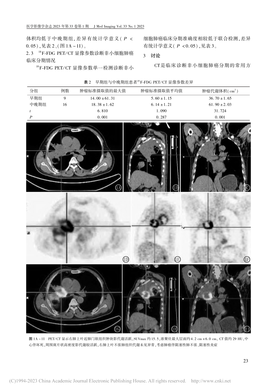 -(18)F-FDG_PE...在非小细胞肺癌分期中的价值_徐华磊.pdf_第3页